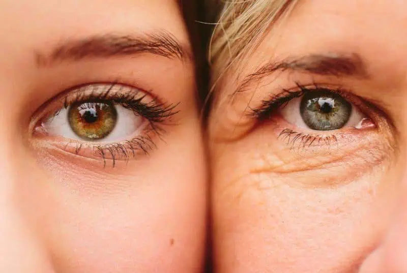 Signs of Aging