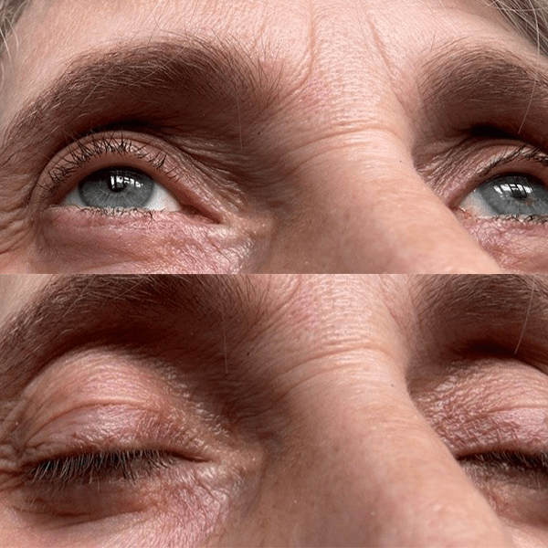 Multi-Peptide Lash & Brows Serum